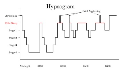 sleep chart with three brief awakening moments highlighted