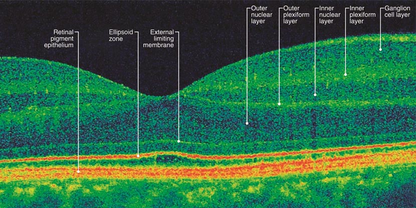 Optical coherence tomography output