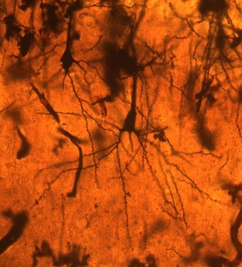 Neurons